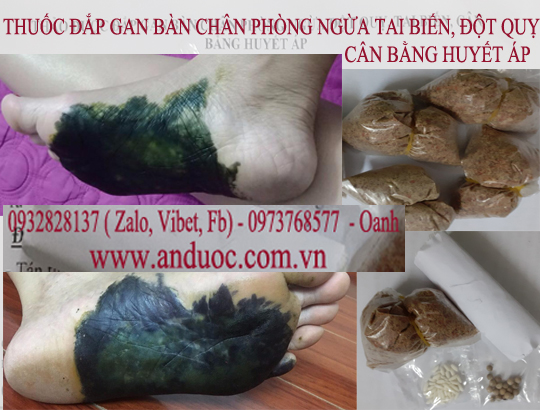 Thuốc đắp gan bàn chân ngừa huyết áp cao, thải độc