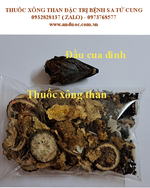 Xông than đầu cua đinh sau sinh