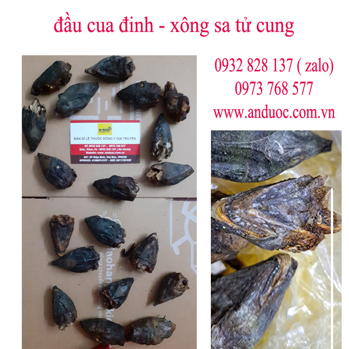 Xông đầu cua đinh cho người bệnh sa dạ con